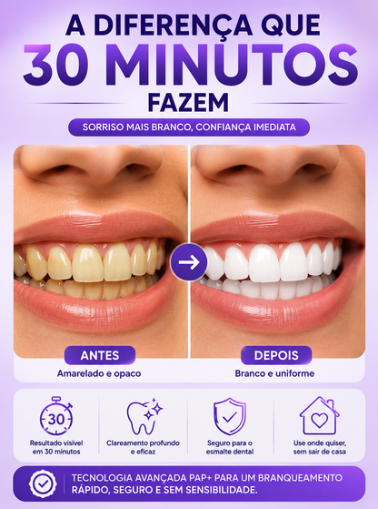 Purple Whitening Strips - Fitas Branqueadoras Roxas.