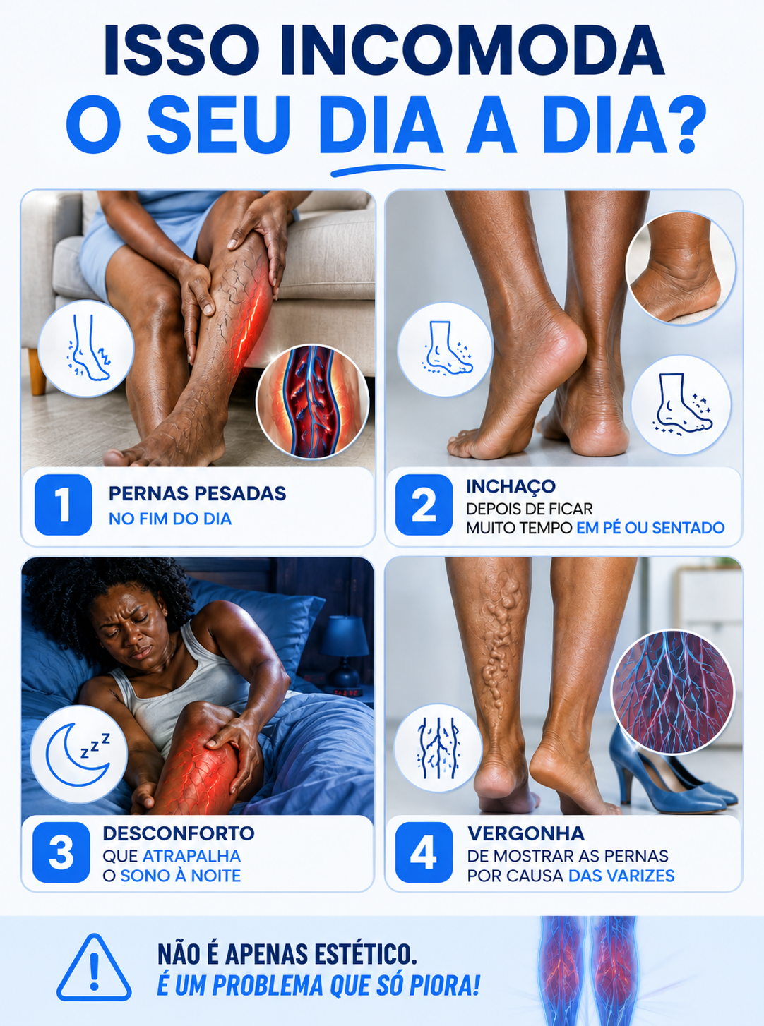 SouthMoon - Spray Para Varizes
