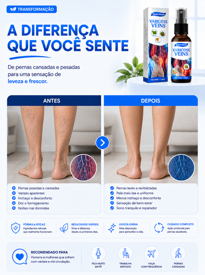 SouthMoon - Spray Para Varizes