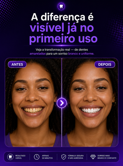Purple Whitening Strips - Fitas Branqueadoras Roxas.