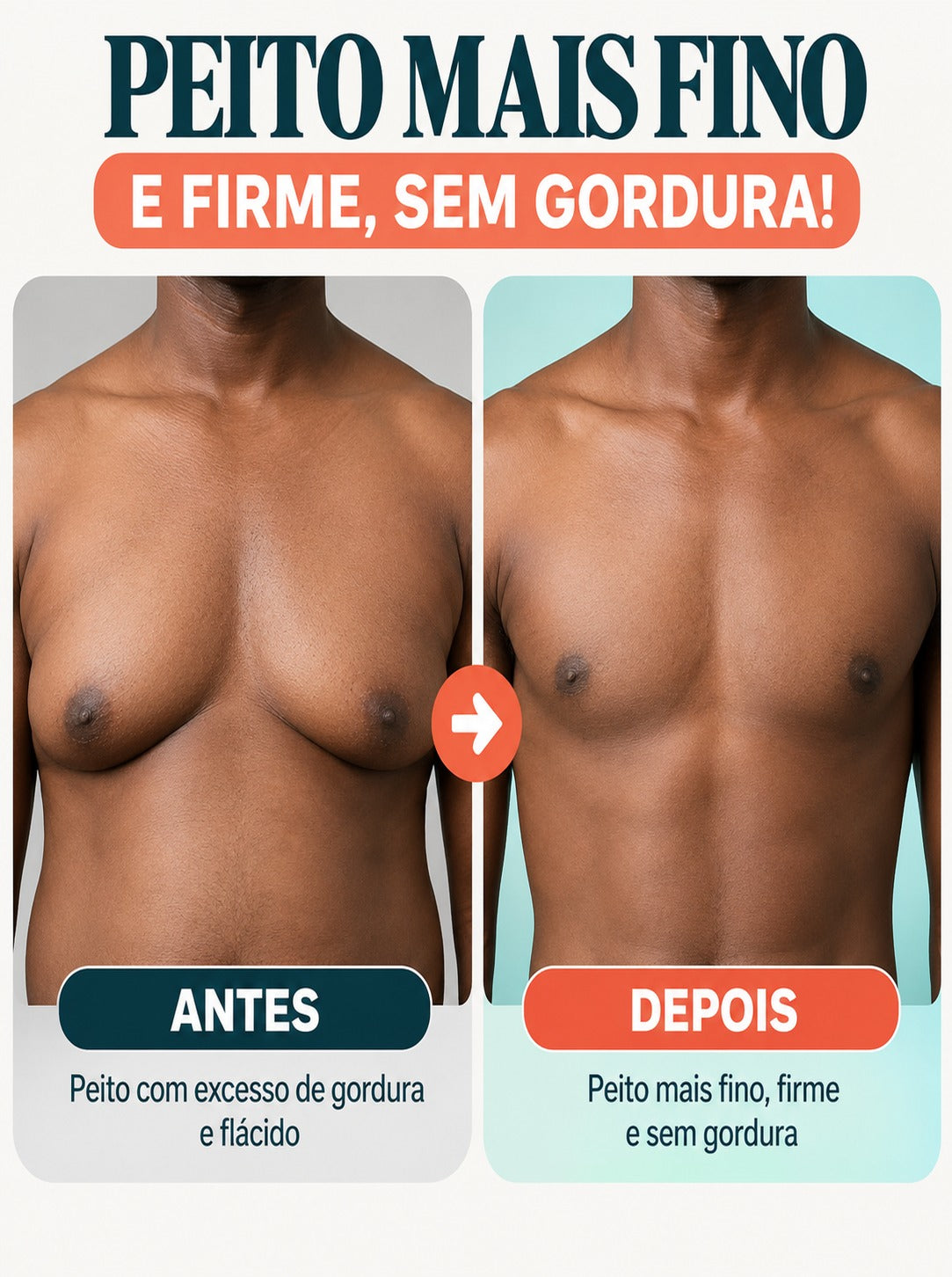 ADESIVO ANTI-GINECOMASTIA?