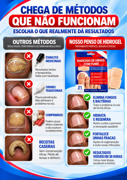 HidroNail™ - Pensos  Reparadores de Unhas.